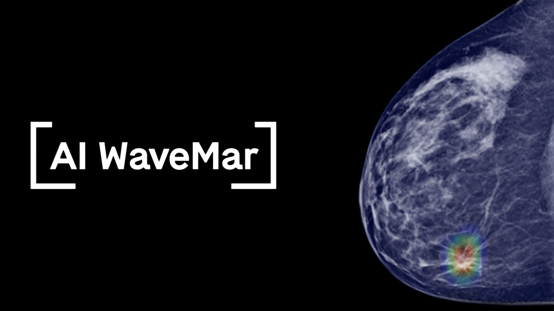 AI WaveMar, una eina d’intel·ligència artificial per optimitzar el cribratge mamogràfic AI WaveMar, una eina d’intel·ligència artificial per optimitzar el cribratge mamogràfic