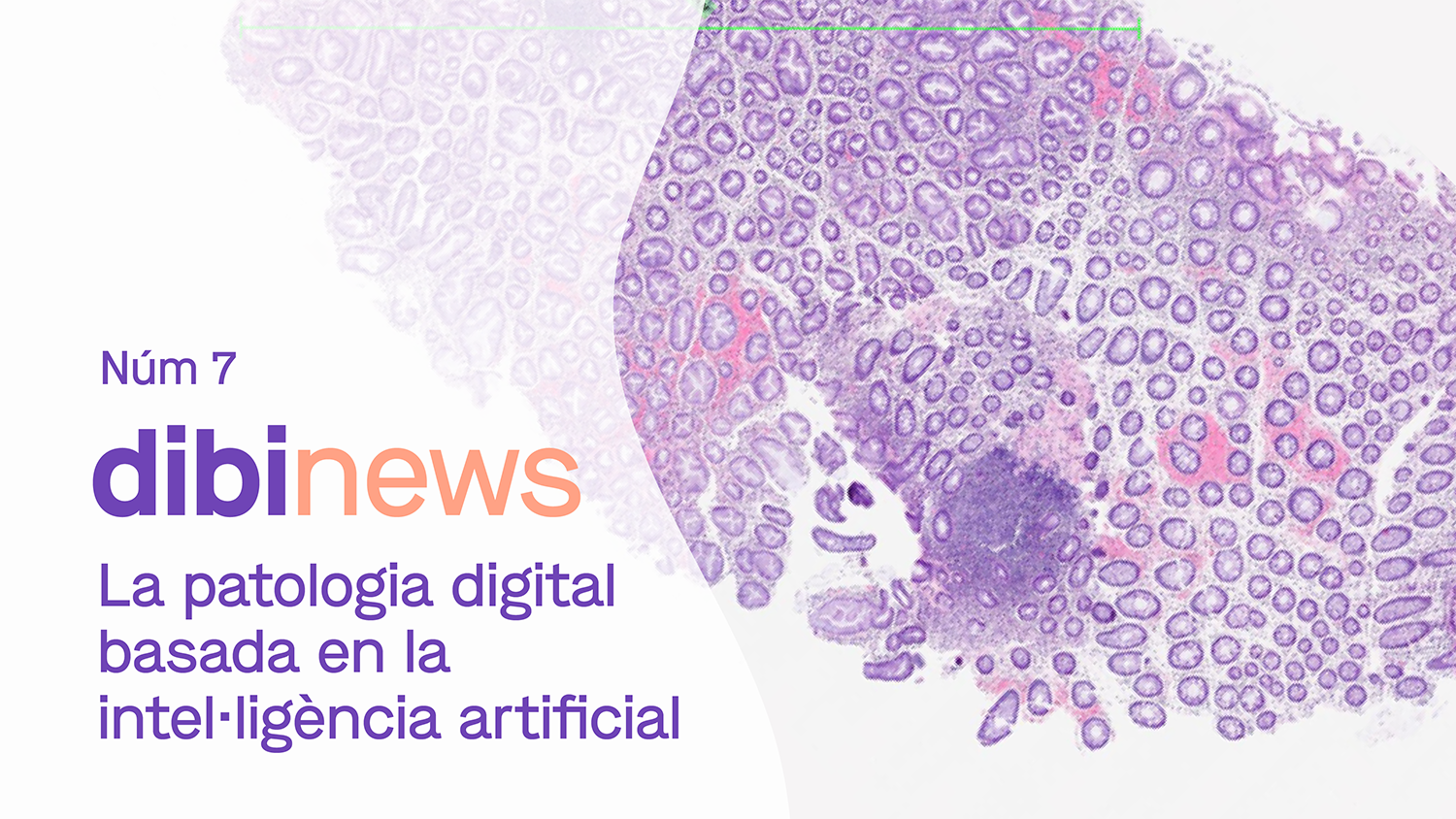 dibinews núm. 7 · La patologia digital basada en la intel·ligència artificial