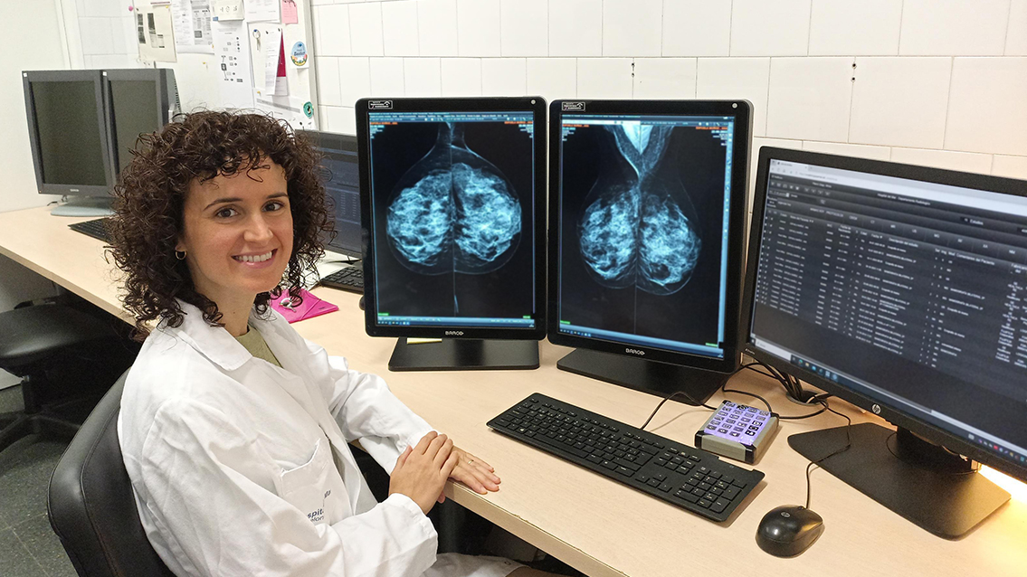 Professionals del Servei de Radiologia i Patologia analitzen l’eficàcia de diferents tècniques diagnòstiques en el maneig de la secreció del mugró Professionals del Servei de Radiologia i Patologia analitzen l’eficàcia de diferents tècniques diagnòstiques en el maneig de la secreció del mugró