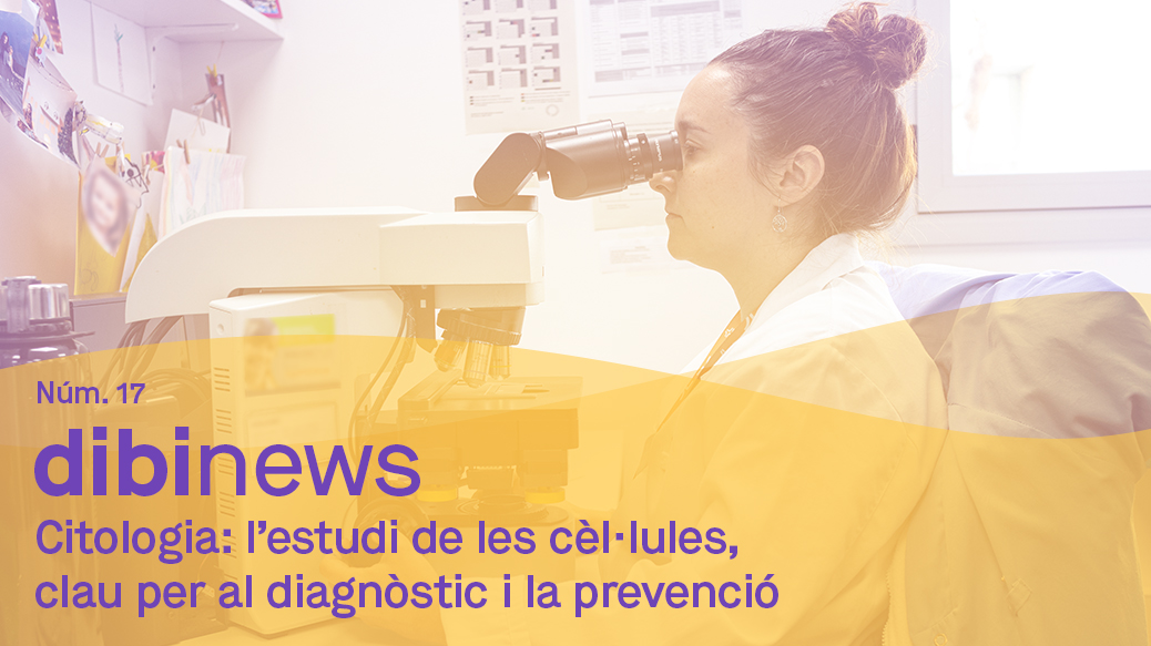 dibinews núm. 17 · Citologia: l’estudi de les cèl·lules, clau per al diagnòstic i la prevenció dibinews núm. 17 · Citologia: l’estudi de les cèl·lules, clau per al diagnòstic i la prevenció