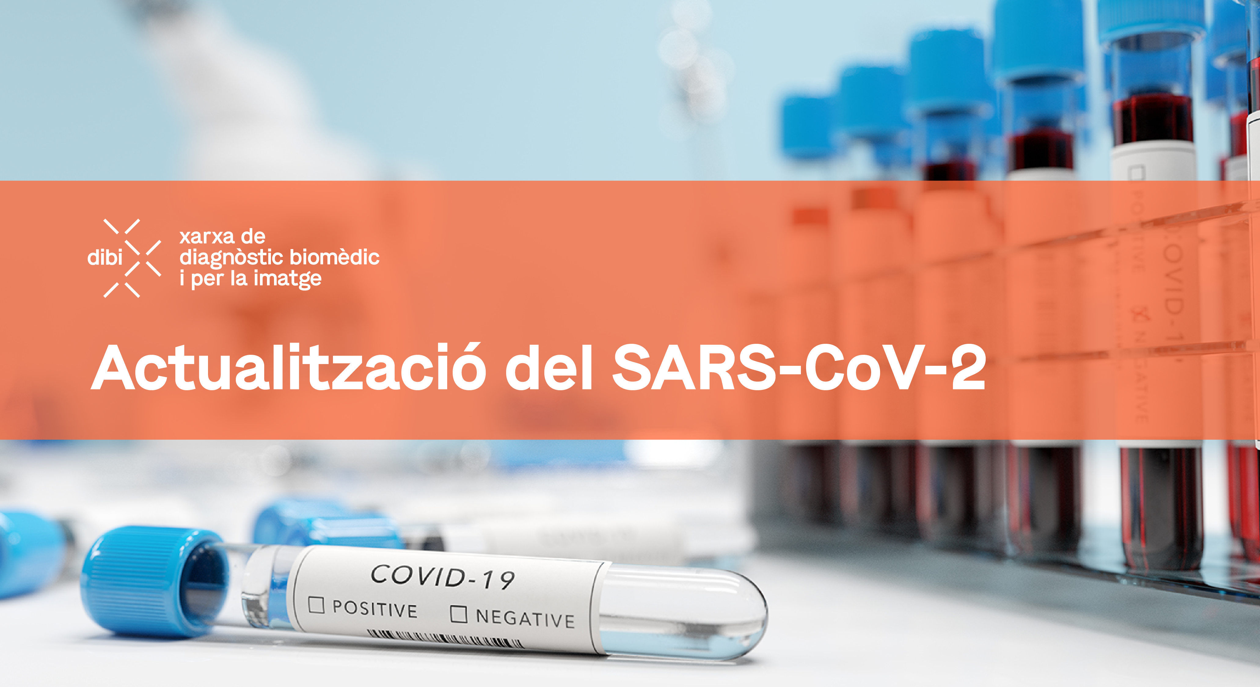 Context actual del SARS-CoV-2, l’aparició de noves variants anomenades FLiRT
